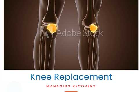 Knee Replacement: Managing Recovery
